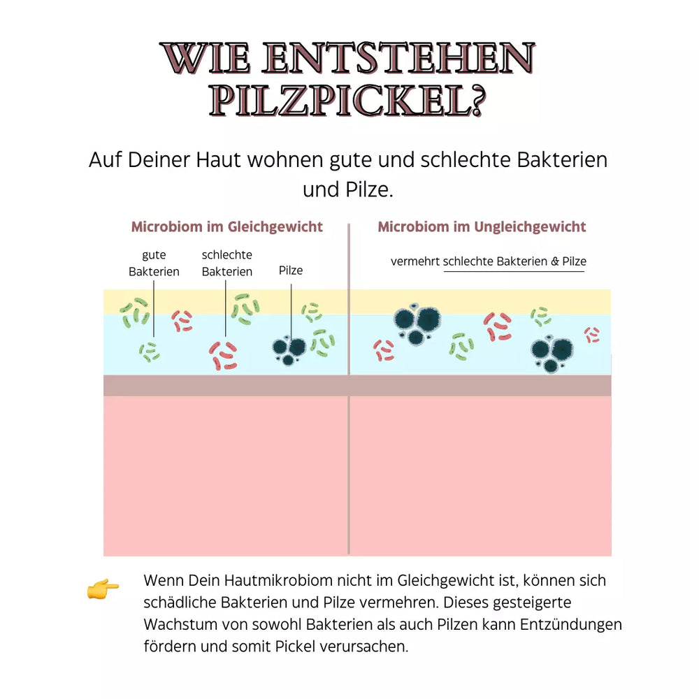 
                      
                        🍄 Mini-Pickel & Unterlagerungen Set
                      
                    